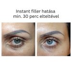 INSTANT FILLER gyors hatású randiszérum 30ml