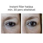 INSTANT FILLER gyors hatású randiszérum 30ml