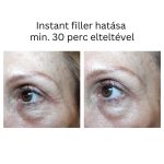 INSTANT FILLER gyors hatású randiszérum 30ml
