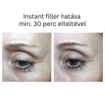 INSTANT FILLER gyors hatású randiszérum 30ml