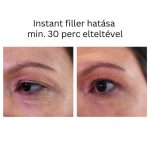 INSTANT FILLER gyors hatású randiszérum 30ml
