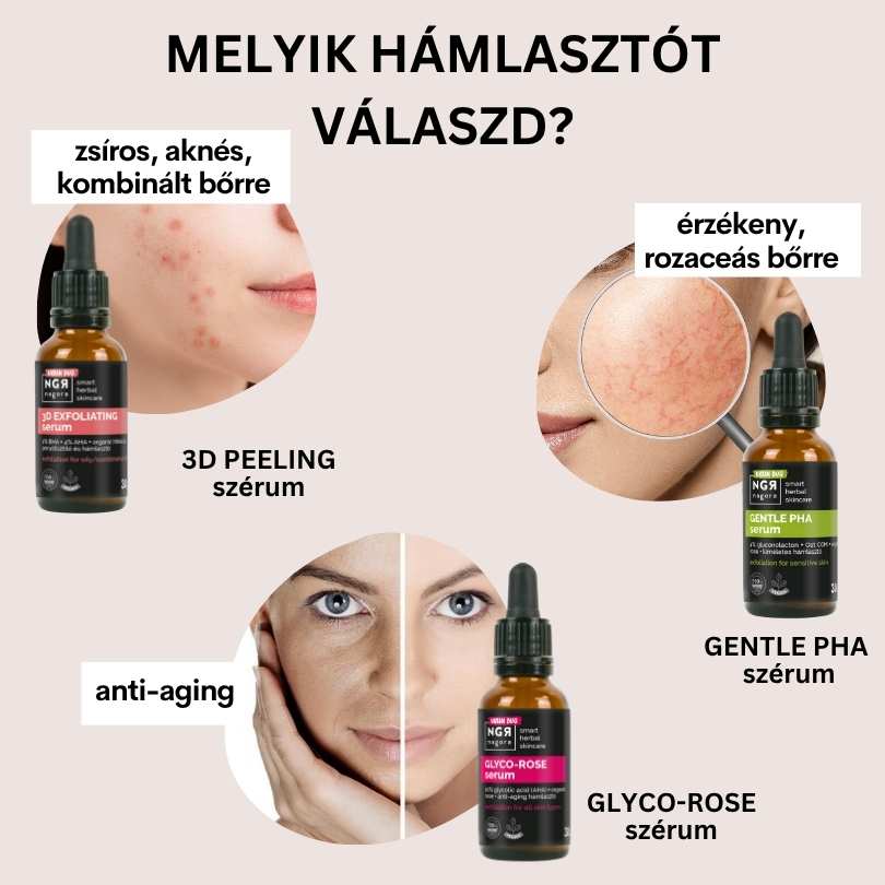 Melyik hámlasztót válaszd?